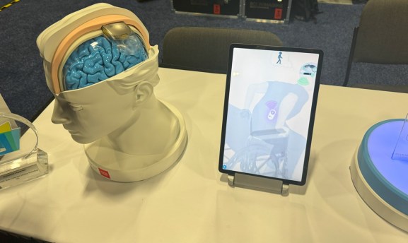 A brain neural interface from Clinatec.